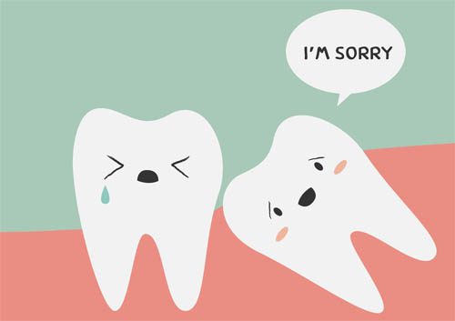 Wisdom tooth picture